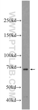 SALL4 Antibody in Western Blot (WB)