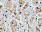 PRKACA Antibody in Immunohistochemistry (Paraffin) (IHC (P))