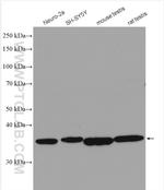 PRKACA Antibody in Western Blot (WB)