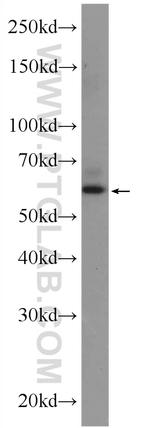 ZNF846 Antibody in Western Blot (WB)