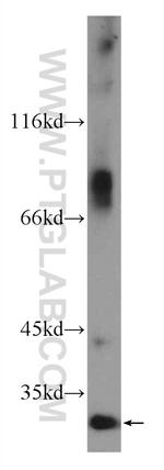 C16orf72 Antibody in Western Blot (WB)