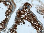 DHX57 Antibody in Immunohistochemistry (Paraffin) (IHC (P))