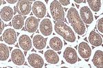 DHX57 Antibody in Immunohistochemistry (Paraffin) (IHC (P))