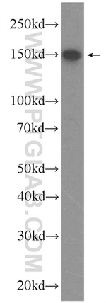 DHX57 Antibody in Western Blot (WB)