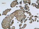 HPSE Antibody in Immunohistochemistry (Paraffin) (IHC (P))