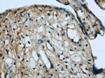 HPSE Antibody in Immunohistochemistry (Paraffin) (IHC (P))