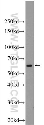 HPSE Antibody in Western Blot (WB)