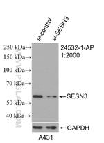 SESN3 Antibody in Western Blot (WB)