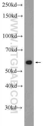 SESN3 Antibody in Western Blot (WB)