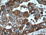 C10orf125 Antibody in Immunohistochemistry (Paraffin) (IHC (P))