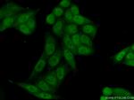 RPRD1B Antibody in Immunocytochemistry (ICC/IF)