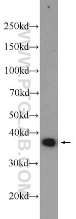 RPRD1B Antibody in Western Blot (WB)