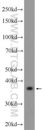 RPRD1B Antibody in Western Blot (WB)