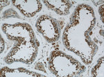 ZNF746 Antibody in Immunohistochemistry (Paraffin) (IHC (P))