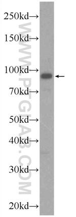 ZNF746 Antibody in Western Blot (WB)