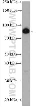 ZNF746 Antibody in Western Blot (WB)