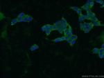 ZBTB8A Antibody in Immunocytochemistry (ICC/IF)