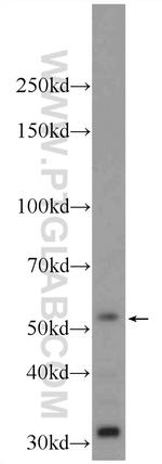 ZBTB8A Antibody in Western Blot (WB)