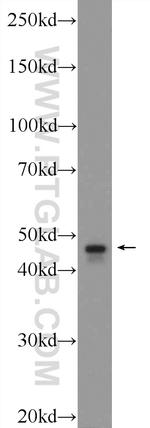 TBCEL Antibody in Western Blot (WB)