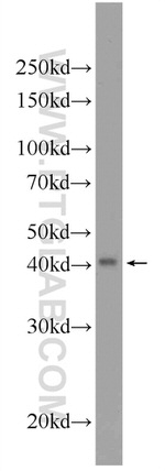 TBCEL Antibody in Western Blot (WB)