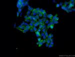 AMOT Antibody in Immunocytochemistry (ICC/IF)