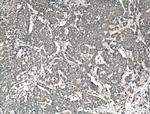 AMOT Antibody in Immunohistochemistry (Paraffin) (IHC (P))