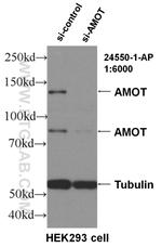 AMOT Antibody in Western Blot (WB)