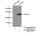 CD41/Integrin alpha 2b Antibody in Immunoprecipitation (IP)