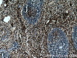 CD41/Integrin alpha 2b Antibody in Immunohistochemistry (Paraffin) (IHC (P))