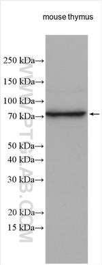 HP1BP3 Antibody in Western Blot (WB)