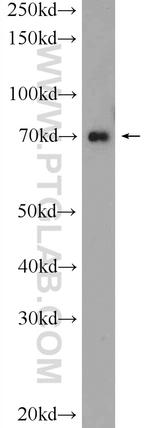 HP1BP3 Antibody in Western Blot (WB)