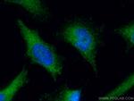 ZW10 Antibody in Immunocytochemistry (ICC/IF)