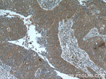 NCAPG Antibody in Immunohistochemistry (Paraffin) (IHC (P))