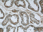 NCAPG Antibody in Immunohistochemistry (Paraffin) (IHC (P))