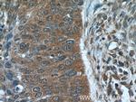 NCAPG Antibody in Immunohistochemistry (Paraffin) (IHC (P))