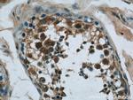 NCAPG Antibody in Immunohistochemistry (Paraffin) (IHC (P))