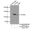 NCAPG Antibody in Immunoprecipitation (IP)