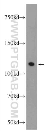 NCAPG Antibody in Western Blot (WB)