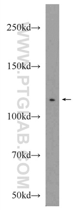 NCAPG Antibody in Western Blot (WB)