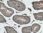 PCOTH Antibody in Immunohistochemistry (Paraffin) (IHC (P))