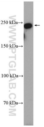 MYO10 Antibody in Western Blot (WB)