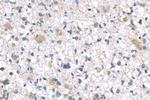 PTPN11 Antibody in Immunohistochemistry (Paraffin) (IHC (P))