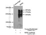 RIM1 Antibody in Immunoprecipitation (IP)