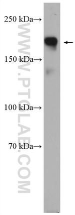 RIM1 Antibody in Western Blot (WB)