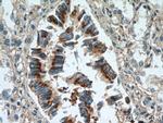 HEATR2 Antibody in Immunohistochemistry (Paraffin) (IHC (P))