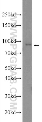 HEATR2 Antibody in Western Blot (WB)