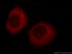 TTC37 Antibody in Immunocytochemistry (ICC/IF)