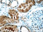 TTC37 Antibody in Immunohistochemistry (Paraffin) (IHC (P))