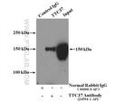 TTC37 Antibody in Immunoprecipitation (IP)