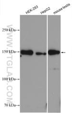 TTC37 Antibody in Western Blot (WB)